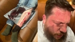 Lithuania Says Hammer Attack On Navalny Aide 'Well-Planned' After Blaming Putin