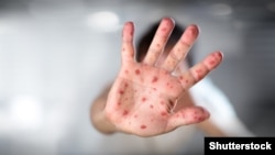 Відмова робити щеплення може коштувати німцям близько 2500 євро